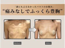 ナチュリ センター南院(NACHUL)/傷みのないふっくら豊胸