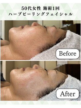 シーフェイス 横浜店(SEE FACE)/肌のハリツヤ透明感トーンアップ