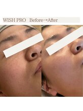 ブルーム(BLOOM)/ウイッシュプロで艶肌に♪