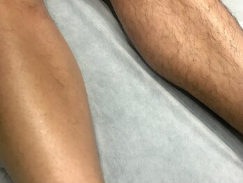 ブラジリアンワックスアンドマツエク グルック/ダブル脱毛