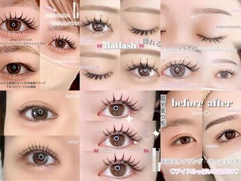 ユーアイ 大名店(Yuueye)の写真/「左右差…まつ毛が上がらない…」等のお悩み→骨格を分析し一人一人の状態に合わせてアドバイス！