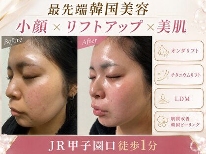 サロン エマ(salon emma)の写真