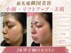 サロン エマ(salon emma)の写真