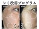 エステサロンパリス(Esthe Salon Paris)の写真
