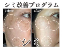 エステサロンパリス(Esthe Salon Paris)