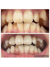 ホワイトアイ 谷町四丁目(WHITE EYE)/ホワイトニング