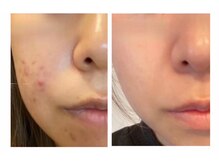 パールプラス 津山店/BeforeAfter