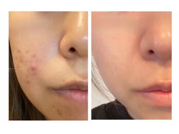 パールプラス 津山店/BeforeAfter