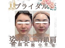 ミエル(Miel)の雰囲気（トータルサロンだからこそ可能！体のライン・肌・小顔・毛まで！）