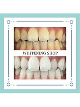 ホワイトニングショップ 福井店/ホワイトニング