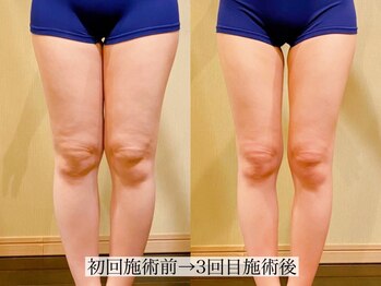 アンジー(Angie)/3回で激変