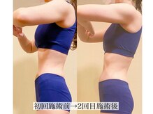 アンジー(Angie)/二の腕スッキリ引き締め