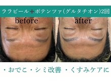 ベルスタイル(Bell style)/当店のお客様症例(美肌ケア)