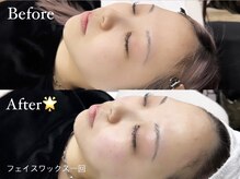 デイジー バイ アルテフィーチェ 梅田(daisy by artefice)/人気のフェイスワックス☆