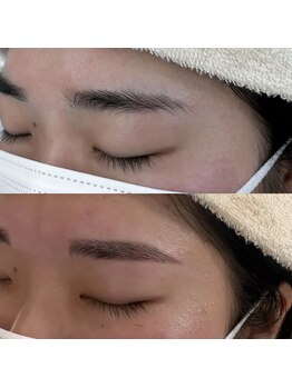 ビュー テンジン 天神 大名(VIEW TENJIN)/アイブロウ(眉毛)WAX脱毛