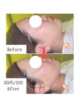 グラシア(gracia)/シミ・毛穴ケア専門店gracia