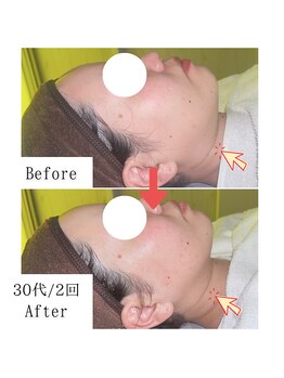 グラシア(gracia)/シミ・毛穴ケア専門店gracia