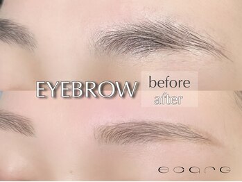 エサージュ 新宿店/ビフォーアフター３