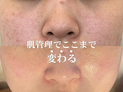 グレーシス(Graces)の写真