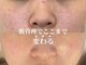 グレーシス(Graces)の写真