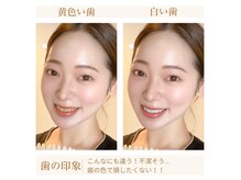 セルフホワイトニングサロン　NA ホワイトニング北谷店の雰囲気（白く輝く歯は第一印象に大きく影響＊数回で理想の白い歯に♪）