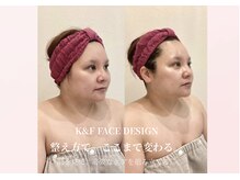 えすてさろん ケイアンドエフ(k&f)の雰囲気（肌を見て、必要なケアを。K&F FACE DESIGN）