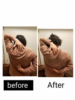 アース エンジェル整体院/ビフォアフ 肩甲骨はがし