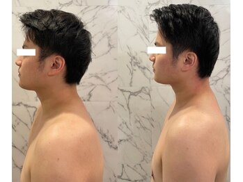 りっつ鍼灸院/EMS姿勢改善