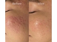 サロンドボーテ サラ(salon de beaute SALA)
