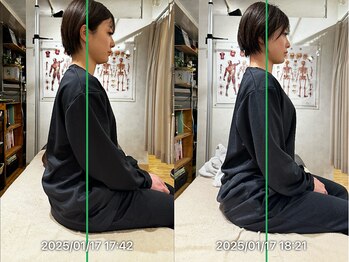 グレフル鍼灸接骨院 整体院 心斎橋/肩こり/骨盤矯正/肩甲骨はがし