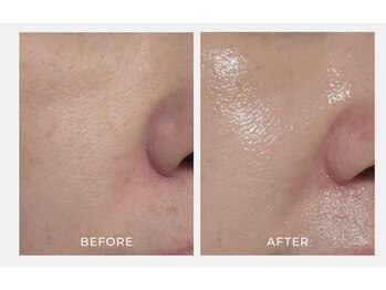 デラッセ サロン ギンザ 藤枝店(Delasser salon GINZA)/韓国iLLONうるツヤ水光肌