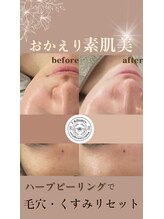 ユーアンドハニー(U&Honey.) 初回限定 美肌ケア
