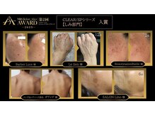 サロン リノ(SALON Lino)/シミ部門入賞