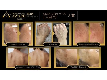 サロン リノ(SALON Lino)/シミ部門入賞
