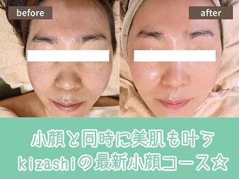 キザシ(kizashi)/ハーブ＆超リフトで変わる