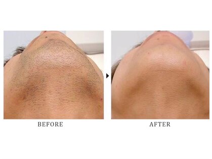 ウォームメモリー(warmmemory)の写真