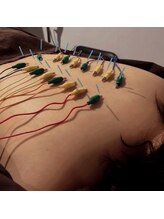 はりの門 神谷町 虎ノ門/背中の抜けない疲れ、自律神経に