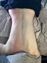 エステサロン BENE/