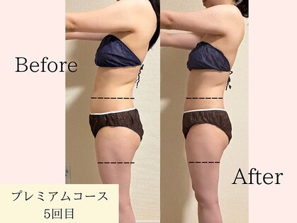 ヨサパーク プア あざみ野(YOSA PARK Pua)の写真