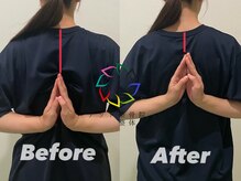 アッド整体院の雰囲気（猫背・巻き肩・反り腰etc国家資格保有のスタッフによる姿勢矯正）
