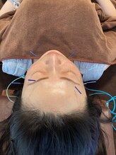 ハリファ鍼灸院 横浜関内院(HariFa鍼灸院)/美容施術