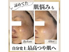 リフトアップサロンespoir