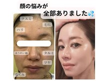 リラビューティー(Lilas Beauty)の雰囲気（当店のエステだけで顔が変わりました！）