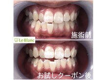 ルブラン 奈良店(Le Blanc)/ホワイトスポット