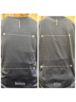 プリューム(PLUME)/骨盤矯正