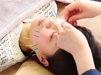 ケアラボ(Care Labo)/【美容鍼】