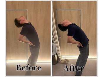 整体ラルース 中目黒(LALUZ)/20代 男性 腰痛、反り腰改善