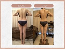 ソウイボディ 武蔵小杉店(Sou-i body)/お客様before→ after