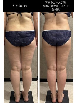 トータルビューティー ミミ(Total Beauty mimi)/全身痩せも夢じゃない！！