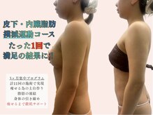エクラ(Eclat)/Eclatの痩身★BeforeAfter9